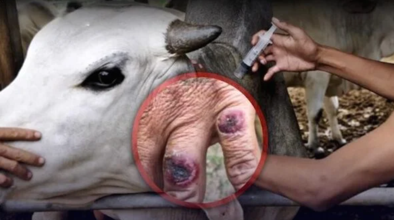 Thailand Laporkan Korban Tewas Kedua Akibat Antraks, 638 Orang Diwaspadai Terinfeksi