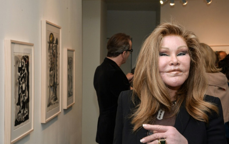 ‘Catwoman’ Wanita Operasi Plastik Ini Meninggal pada Usia 79 Tahun